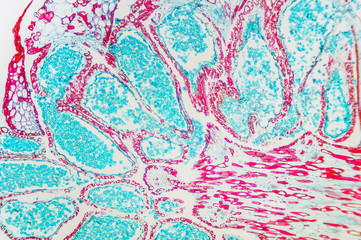Pinus Male Strobile- cell microscopic