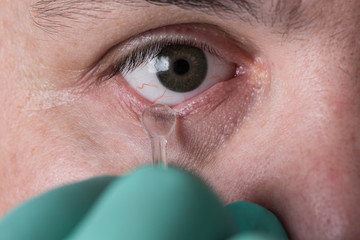 Glass eye prosthetic extraction of Ocular prosthesis