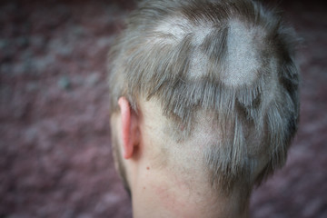 Young man closeup portrait with damaged hair