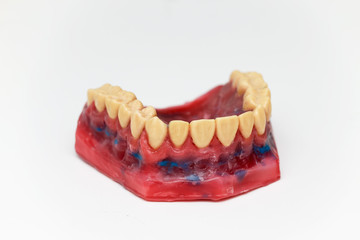 Technical shots of models on a dental  laboratory