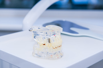 Close up glass jaw model with implanted dentures on the working dental table surface