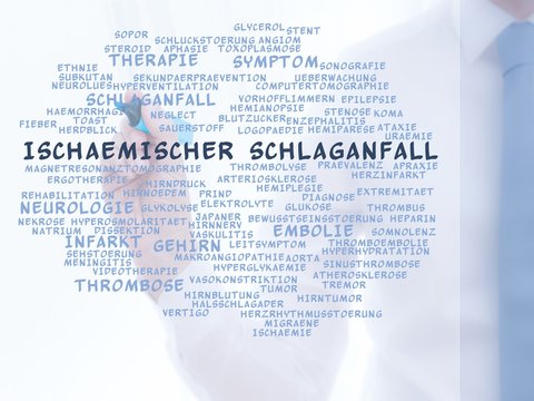 Isch&auml;mischer Schlaganfall