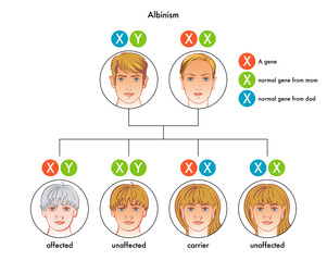 albinism