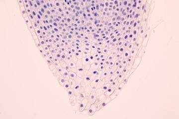 Root tip of Onion and Mitosis cell in the Root tip of Onion under a microscope.