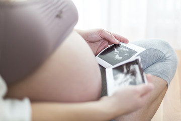 Schwangere Frau betrachtet Ultraschall-Bilder