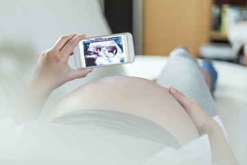 Schwangere Frau betrachtet Ultraschall-Bild auf dem Smartphone