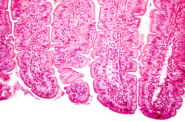 Villi of small intestine, light micrograph