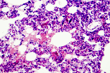 Microscopic photo showing lung tissue