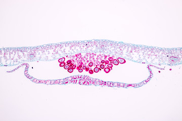 Indusium Fern under microscope view.