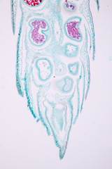 Strobilus of Selaginella under microscope view.