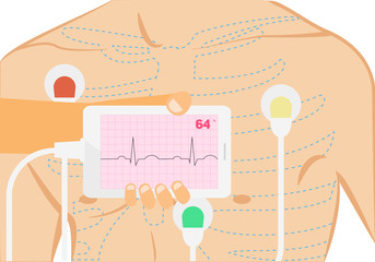 Mobile ecg conceptual illustration. Hand holding smartphone with ecg strip