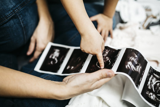 Little boy looking at ultrasound scans of his pregnant mother, partial view