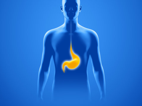 Magen mit Oberk&ouml;rper-Silhouette &ndash; Magenbeschwerden und Sodbrennen