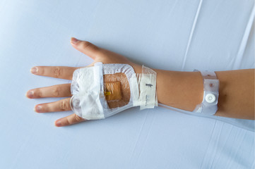 saline intravenous secured transparent dressing