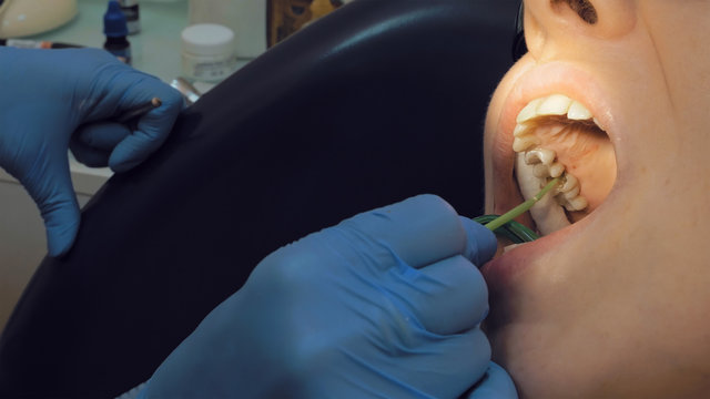 Woman at the dentist clinic office gets dental medical examination and treatment. Close up shot. Odontic and mouth health is important part of modern human life that dentistry help with.