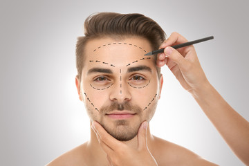 Surgeon drawing marks on male face against gray background. Plastic surgery concept