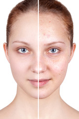 Befor and after treatment. Beautiful woman's portrait isolated on white background, before and...