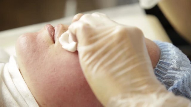 Diamond microdermabrasion, peeling treatment at cosmetic beauty spa clinic. woman getting a vacuum microdermabrasion procedure