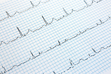 Electrocardiogram in paper form, closeup