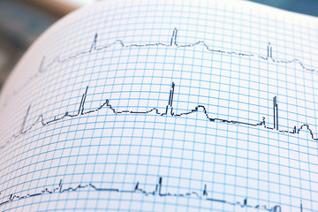 Electrocardiogram in paper form, closeup
