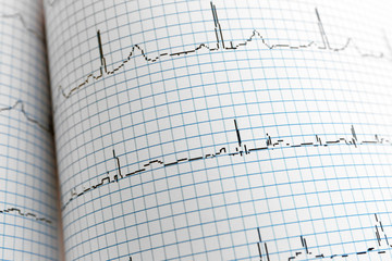 Electrocardiogram in paper form, closeup