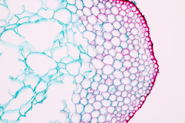 Pine Stem on the slide under microscope view.