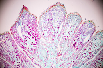 Pine cone and Pine Ovulate on the slide under microscope view.