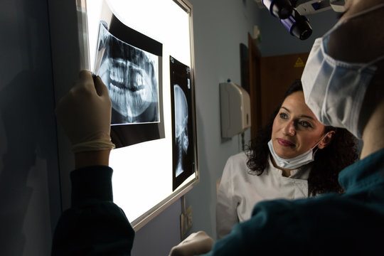 La radiografia del dentista