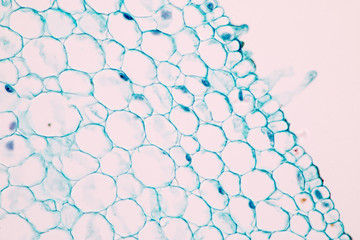 Root and Typical Dicot on the slide under microscope view.