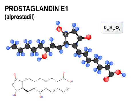 Prostaglandin E1, or alprostadil