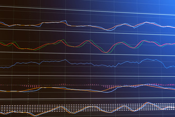 Candle stick graph chart of stock market investment tradin busin