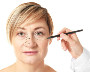 Surgeon drawing marks on female face against white background. Plastic surgery concept