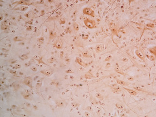 Human neurons cells from the spinal cord under microscope view