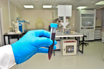 Laboratory examination of the blood.