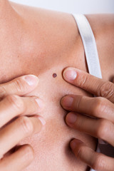 femme examinant un grain de beauté sur la peau