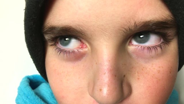 Extreme close up of a teenage boys eyes