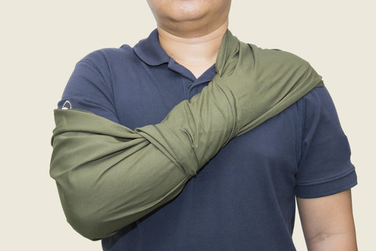 arm sling improvise by cloth triangle apply