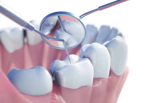 Zahnuntersuchung - Vorsorge 1