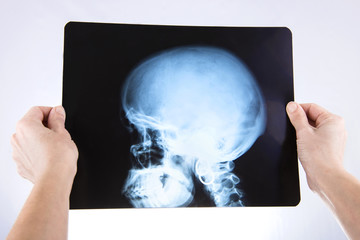 X rays of head