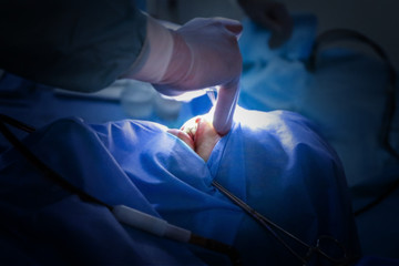 Operating of patient in modern hospital