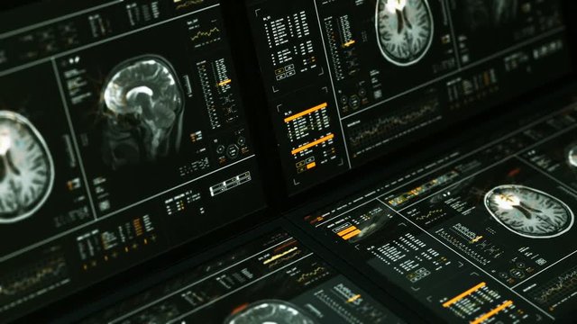 MRI Brain Scan Analysis Monitors