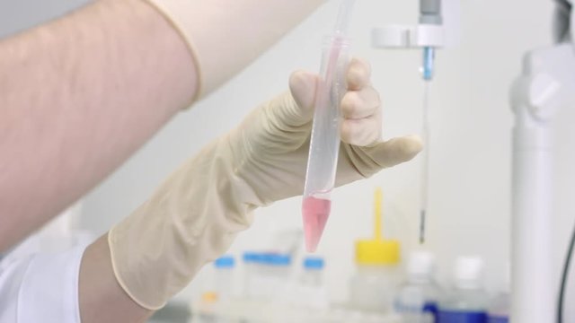 Close up of measuring ph of ivf material