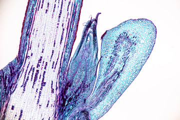 Background of Abscission layer cell under the microscope.