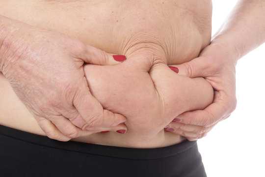 femme senior pinçant graisse abdominale sur son ventre