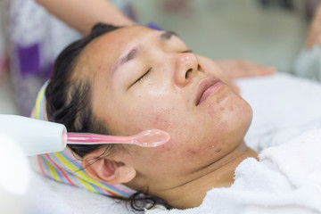 Beauty treatment of face skin with high frequency infrared spot or laser spot remover in SPA center.