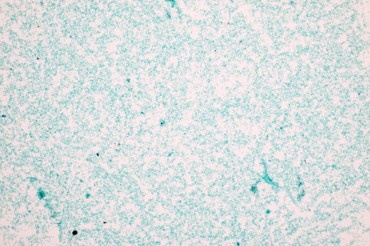 Scenedesmus under the microscope.