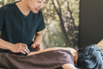 Therapist Giving acupuncture Treatment To a Japanese Woman - obrazy, fototapety, plakaty