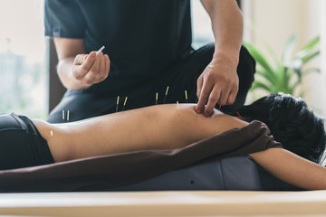 Therapist Giving acupuncture Treatment To a Japanese Woman