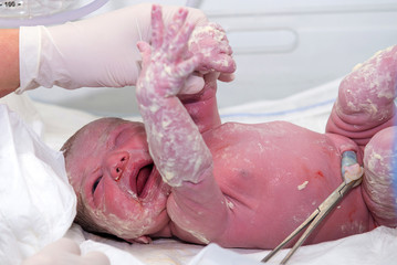 Newborn baby after birth in hospital