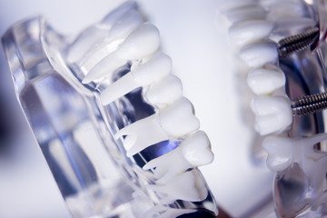 Dentists dental teeth model